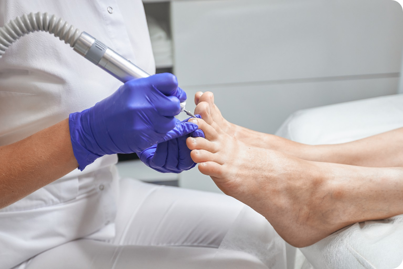 Podóloga especializada en La Ligua - Tratamiento profesional de pie diabético y uñas encarnadas